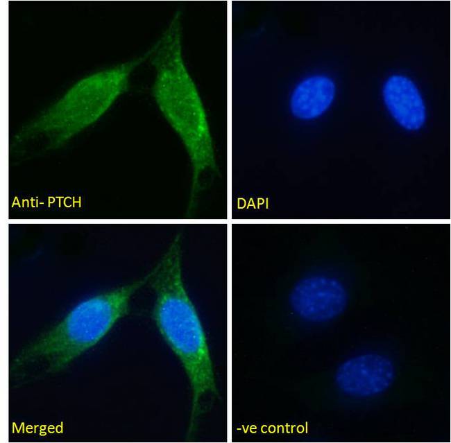 PTCH1 / Patched 1 Antibody - PTCH1 / Patched 1 antibody immunofluorescence analysis of paraformaldehyde fixed NIH3T3 cells, permeabilized with 0.15% Triton. Primary incubation 1hr (5ug/ml) followed by Alexa Fluor 488 secondary antibody (2ug/ml), showing Golgi/membrane staining. The nuclear stain is DAPI (blue). Negative control: Unimmunized goat IgG (10ug/ml) followed by Alexa Fluor 488 secondary antibody (2ug/ml).