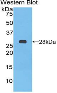 PTCH1 / Patched 1 Antibody - Western blot of recombinant PTCH1 / Patched.  This image was taken for the unconjugated form of this product. Other forms have not been tested.