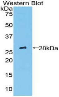 PTCH1 / Patched 1 Antibody - Western blot of recombinant PTCH1 / Patched.  This image was taken for the unconjugated form of this product. Other forms have not been tested.
