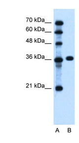 PTCH1 / Patched 1 Antibody - PTCH1 antibody Western blot of Jurkat lysate. This image was taken for the unconjugated form of this product. Other forms have not been tested.