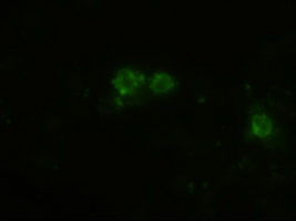 PTCH1 / Patched 1 Antibody - Anti-Patched1 mouse monoclonal antibody  immunofluorescent staining of HeLa cells transiently transfected by pCMV6-ENTRY PTCH1.