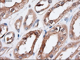 PTCH1 / Patched 1 Antibody - IHC of paraffin-embedded kidney using anti-PTCH1 mouse monoclonal antibody.