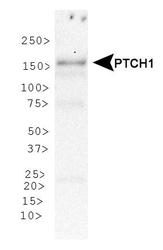PTCH1 / Patched 1 Antibody - Patched 1 Antibody - WB analysis of Patched 1 in human skeletal muscle protein.  This image was taken for the unconjugated form of this product. Other forms have not been tested.