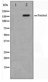 PTCH1 / Patched 1 Antibody - Western blot of mouse muscle cell lysate using Patched Antibody