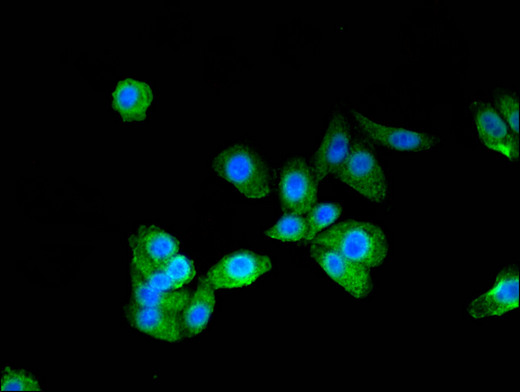 PTCH1 / Patched 1 Antibody - Immunofluorescent analysis of HepG2 cells using PTCH1 Antibody at a dilution of 1:100 and Alexa Fluor 488-congugated AffiniPure Goat Anti-Rabbit IgG(H+L)