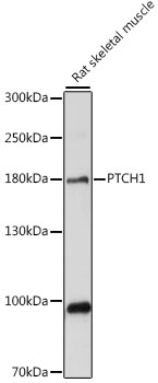 PTCH1 / Patched 1 Antibody - Western blot analysis of extracts of rat skeletal muscle, using PTCH1 antibody at 1:1000 dilution. The secondary antibody used was an HRP Goat Anti-Rabbit IgG (H+L) at 1:10000 dilution. Lysates were loaded 25ug per lane and 3% nonfat dry milk in TBST was used for blocking. An ECL Kit was used for detection and the exposure time was 5s.