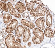PTCH1 / Patched 1 Antibody - 1:100 staining human kidney tissue by IHC-P. The tissue was formaldehyde fixed and a heat mediated antigen retrieval step in citrate buffer was performed. The tissue was then blocked and incubated with the antibody for 1.5 hours at 22°C. An HRP conjugated goat anti-rabbit antibody was used as the secondary.