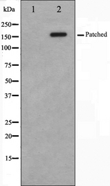 PTCH1 / Patched 1 Antibody - Western blot analysis on mouse muscle cell lysates using Patched antibody. The lane on the left is treated with the antigen-specific peptide.