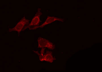 PTCH1 / Patched 1 Antibody - Staining 293 cells by IF/ICC. The samples were fixed with PFA and permeabilized in 0.1% Triton X-100, then blocked in 10% serum for 45 min at 25°C. The primary antibody was diluted at 1:200 and incubated with the sample for 1 hour at 37°C. An Alexa Fluor 594 conjugated goat anti-rabbit IgG (H+L) Ab, diluted at 1/600, was used as the secondary antibody.