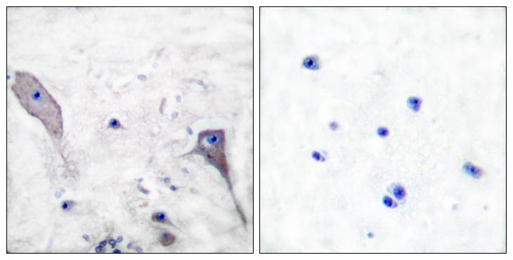 PTCH1 / Patched 1 Antibody - Peptide - + Immunohistochemical analysis of paraffin-embedded human brain tissue using Patched antibody.