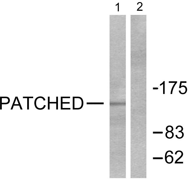 PTCH1 / Patched 1 Antibody - Western blot analysis of extracts from mouse muscle cells, using Patched antibody.