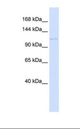 PTCH2 / Patched 2 Antibody - Placenta lysate. Antibody concentration: 1.0 ug/ml. Gel concentration: 6-18%.  This image was taken for the unconjugated form of this product. Other forms have not been tested.