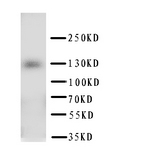 PTCH2 / Patched 2 Antibody - WB of ptch2 antibody. WB: HELA Cell Lysate.