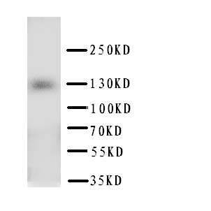 PTCH2 / Patched 2 Antibody - WB of ptch2 antibody. WB: HELA Cell Lysate.