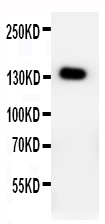 PTCH2 / Patched 2 Antibody - Anti-PTCH2 antibody, Western blottingWB: HELA Cell Lysate