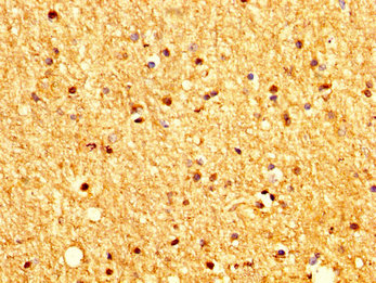 PTCH2 / Patched 2 Antibody - Immunohistochemistry image at a dilution of 1:200 and staining in paraffin-embedded human brain tissue performed on a Leica BondTM system. After dewaxing and hydration, antigen retrieval was mediated by high pressure in a citrate buffer (pH 6.0) . Section was blocked with 10% normal goat serum 30min at RT. Then primary antibody (1% BSA) was incubated at 4 °C overnight. The primary is detected by a biotinylated secondary antibody and visualized using an HRP conjugated SP system.