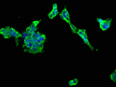 PTCH2 / Patched 2 Antibody - Immunofluorescence staining of 293 cells with PTCH2 Antibody at 1:66, counter-stained with DAPI. The cells were fixed in 4% formaldehyde, permeabilized using 0.2% Triton X-100 and blocked in 10% normal Goat Serum. The cells were then incubated with the antibody overnight at 4°C. The secondary antibody was Alexa Fluor 488-congugated AffiniPure Goat Anti-Rabbit IgG(H+L).