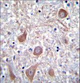 PTCHD1 Antibody - PTCHD1 Antibody immunohistochemistry of formalin-fixed and paraffin-embedded human brain tissue followed by peroxidase-conjugated secondary antibody and DAB staining.