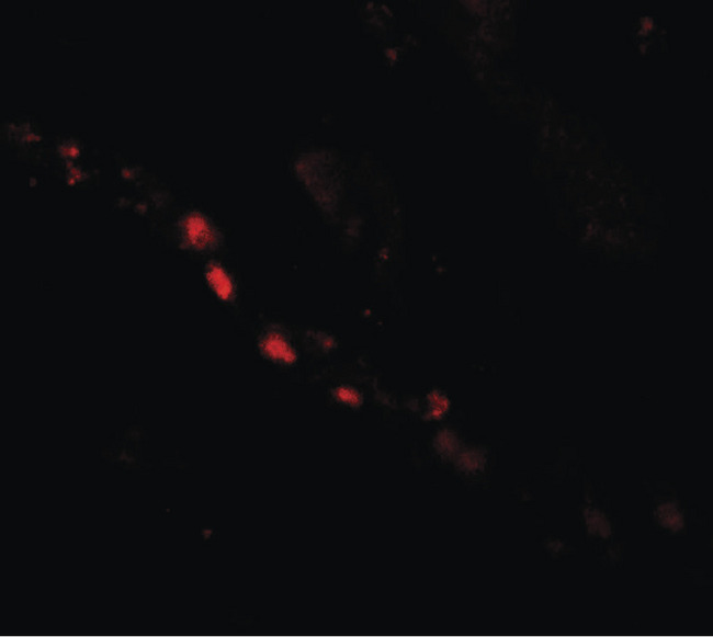 PTCHD2 Antibody - Immunofluorescence of PTCHD2 in human kidney tissue with PTCHD2 antibody at 20 ug/ml.