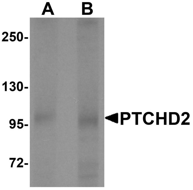 PTCHD2 Antibody - Western blot analysis of PTCHD2 in mouse kidney tissue lysate with PTCHD2 antibody at (A) 1 and (B) 2 ug/ml.