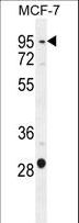 PTCHD3 Antibody - PTCHD3 Antibody western blot of MCF-7 cell line lysates (35 ug/lane). The PTCHD3 antibody detected the PTCHD3 protein (arrow).