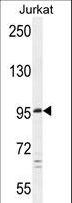 PTCHD4 / C6orf138 Antibody - C6orf138 Antibody western blot of Jurkat cell line lysates (35 ug/lane). The C6orf138 antibody detected the C6orf138 protein (arrow).