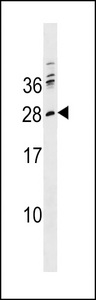 PTCRA Antibody - PTCRA Antibody western blot of K562 cell line lysates (35 ug/lane). The PTCRA antibody detected the PTCRA protein (arrow).