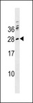 PTCRA Antibody - PTCRA Antibody western blot of K562 cell line lysates (35 ug/lane). The PTCRA antibody detected the PTCRA protein (arrow).