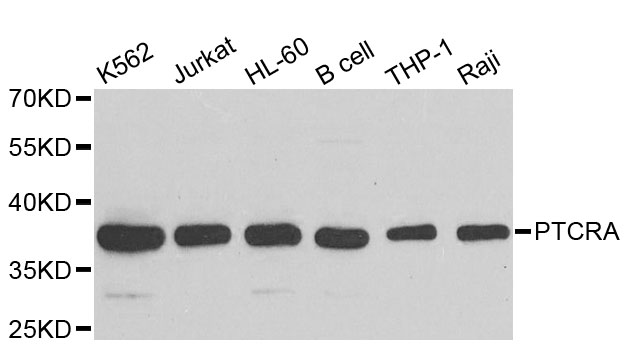 PTCRA Antibody - Western blot analysis of extracts of various cell lines.