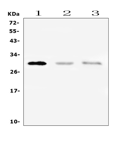 PTCRA Antibody - Western blot analysis of PTCRA using anti-PTCRA antibody. Electrophoresis was performed on a 5-20% SDS-PAGE gel at 70V (Stacking gel) / 90V (Resolving gel) for 2-3 hours. The sample well of each lane was loaded with 50ug of sample under reducing conditions. Lane 1: human A375 whole cell lysate,Lane 2: human HL-60 whole cell lysate,Lane 3: human CCRM-CEM whole cell lysate. After Electrophoresis, proteins were transferred to a Nitrocellulose membrane at 150mA for 50-90 minutes. Blocked the membrane with 5% Non-fat Milk/ TBS for 1.5 hour at RT. The membrane was incubated with rabbit anti-PTCRA antigen affinity purified polyclonal antibody at 0.5 µg/mL overnight at 4°C, then washed with TBS-0.1% Tween 3 times with 5 minutes each and probed with a goat anti-rabbit IgG-HRP secondary antibody at a dilution of 1:10000 for 1.5 hour at RT. The signal is developed using an Enhanced Chemiluminescent detection (ECL) kit with Tanon 5200 system. A specific band was detected for PTCRA at approximately 29KD. The expected band size for PTCRA is at 29KD.