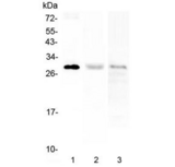 PTCRA Antibody - Western blot testing of human 1) A375, 2) HL60 and 3) CCRM-CEM cell lysate with PTCRA antibody at 0.5ug/ml. Predicted molecular weight ~29 kDa.