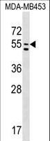 PTDSS1 Antibody - PTDSS1 Antibody western blot of MDA-MB453 cell line lysates (35 ug/lane). The PTDSS1 antibody detected the PTDSS1 protein (arrow).