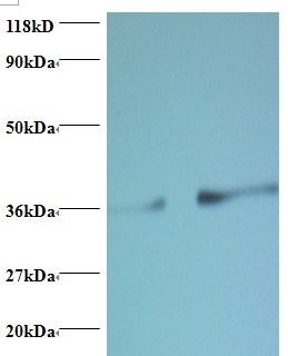 PTDSS1 Antibody - Western blot of Phosphatidylserine synthase 1 antibody at 2 ug/ml. Lane 1: EC109 whole cell lysate. Lane 2: 293T whole cell lysate. Secondary: Goat polyclonal to Rabbit IgG at 1:15000 dilution. Predicted band size: 52 kDa. Observed band size: 36 kDa.  This image was taken for the unconjugated form of this product. Other forms have not been tested.