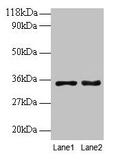 PTDSS1 Antibody - Western blot All lanes: Phosphatidylserine synthase 1 antibody at 2µg/ml Lane 1: EC109 whole cell lysate Lane 2: 293T whole cell lysate Secondary Goat polyclonal to rabbit IgG at 1/15000 dilution Predicted band size: 56, 39, 35 kDa Observed band size: 35 kDa