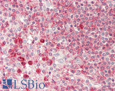 PTDSS1 Antibody - Human Spleen: Formalin-Fixed, Paraffin-Embedded (FFPE).  This image was taken for the unconjugated form of this product. Other forms have not been tested.