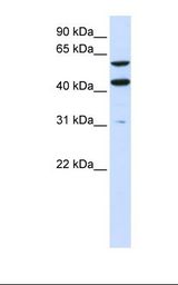 PTDSS1 Antibody - 293T cell lysate. Antibody concentration: 1.0 ug/ml. Gel concentration: 12%.  This image was taken for the unconjugated form of this product. Other forms have not been tested.