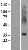 PTDSS1 Protein - Western validation with an anti-DDK antibody * L: Control HEK293 lysate R: Over-expression lysate