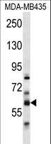 PTDSS2 Antibody - PTDSS2 Antibody western blot of MDA-MB435 cell line lysates (35 ug/lane). The PTDSS2 antibody detected the PTDSS2 protein (arrow).