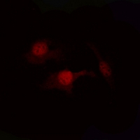 PTEN Antibody - Immunofluorescent analysis of PTEN (pS380/T382/T383) staining in HeLa cells. Formalin-fixed cells were permeabilized with 0.1% Triton X-100 in TBS for 5-10 minutes and blocked with 3% BSA-PBS for 30 minutes at room temperature. Cells were probed with the primary antibody in 3% BSA-PBS and incubated overnight at 4 deg C in a humidified chamber. Cells were washed with PBST and incubated with a DyLight 594-conjugated secondary antibody (red) in PBS at room temperature in the dark. DAPI was used to stain the cell nuclei (blue).