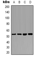 PTEN Antibody - Western blot analysis of PTEN expression in HeLa (A); MCF7 (B); NIH3T3 (C); mouse brain (D) whole cell lysates.