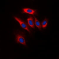 PTEN Antibody - Immunofluorescent analysis of PTEN staining in HeLa cells. Formalin-fixed cells were permeabilized with 0.1% Triton X-100 in TBS for 5-10 minutes and blocked with 3% BSA-PBS for 30 minutes at room temperature. Cells were probed with the primary antibody in 3% BSA-PBS and incubated overnight at 4 deg C in a humidified chamber. Cells were washed with PBST and incubated with a DyLight 594-conjugated secondary antibody (red) in PBS at room temperature in the dark. DAPI was used to stain the cell nuclei (blue).
