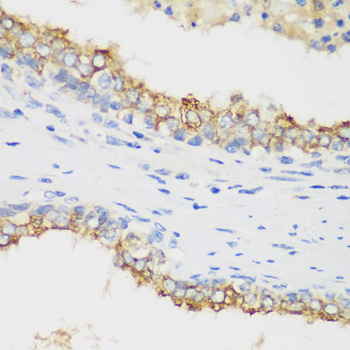 PTEN Antibody - Immunohistochemistry of paraffin-embedded human prostate.