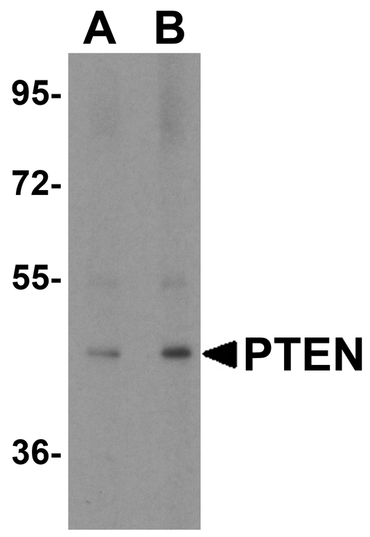 PTEN Antibody - Western blot analysis of PTEN in human brain tissue lysate with PTEN antibody at (A) 1 and (B) 2 ug/mL..