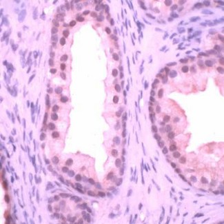 PTEN Antibody - Prostate stained with Anti-PTFN antibody