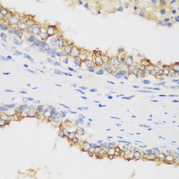 PTEN Antibody - Immunohistochemistry of paraffin-embedded human prostate using PTEN antibody at dilution of 1:100 (40x lens).