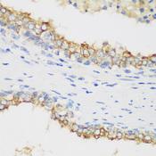 PTEN Antibody - Immunohistochemistry of paraffin-embedded human prostate using PTEN antibody at dilution of 1:100 (40x lens).