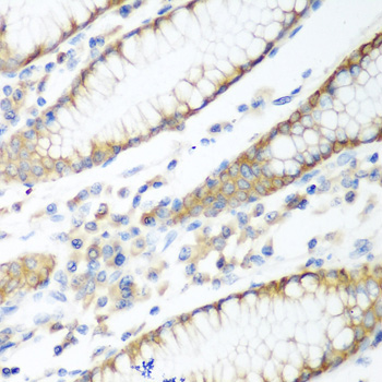 PTEN Antibody - Immunohistochemistry of paraffin-embedded human stomach using PTEN antibody at dilution of 1:100 (40x lens).