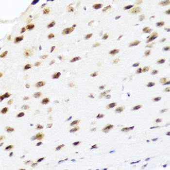 PTEN Antibody - Immunohistochemistry of paraffin-embedded mouse brain using PTEN antibody at dilution of 1:100 (40x lens).