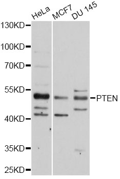 PTEN Antibody - Western blot analysis of extracts of various cell lines, using PTEN antibody at 1:1000 dilution. The secondary antibody used was an HRP Goat Anti-Rabbit IgG (H+L) at 1:10000 dilution. Lysates were loaded 25ug per lane and 3% nonfat dry milk in TBST was used for blocking. An ECL Kit was used for detection and the exposure time was 30s.
