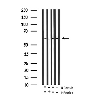 PTEN Antibody - Western blot analysis of Phospho-PTEN (Ser370) expression in various lysates